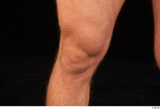 Herbert 10yers knee nude 0003.jpg